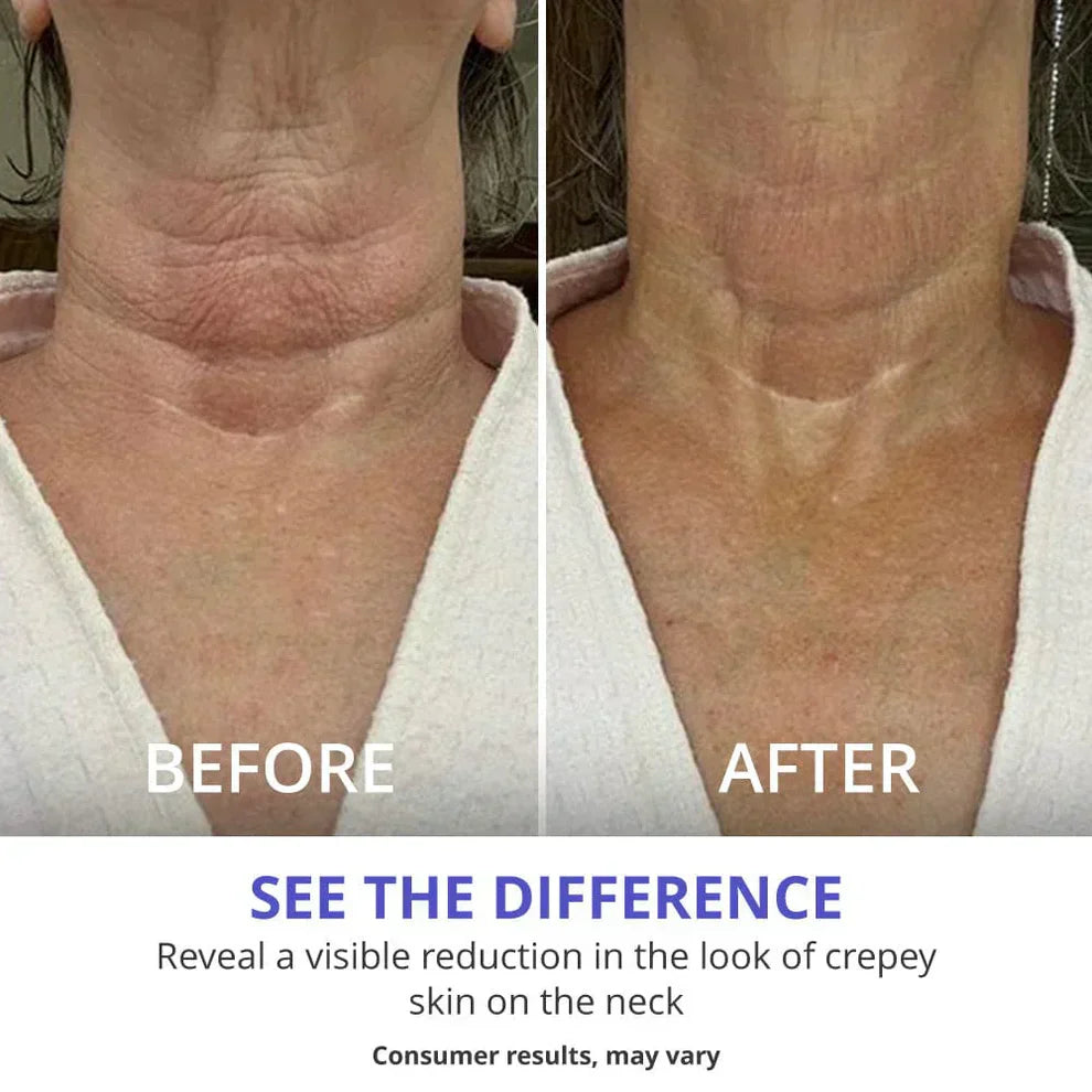 Neck Cream